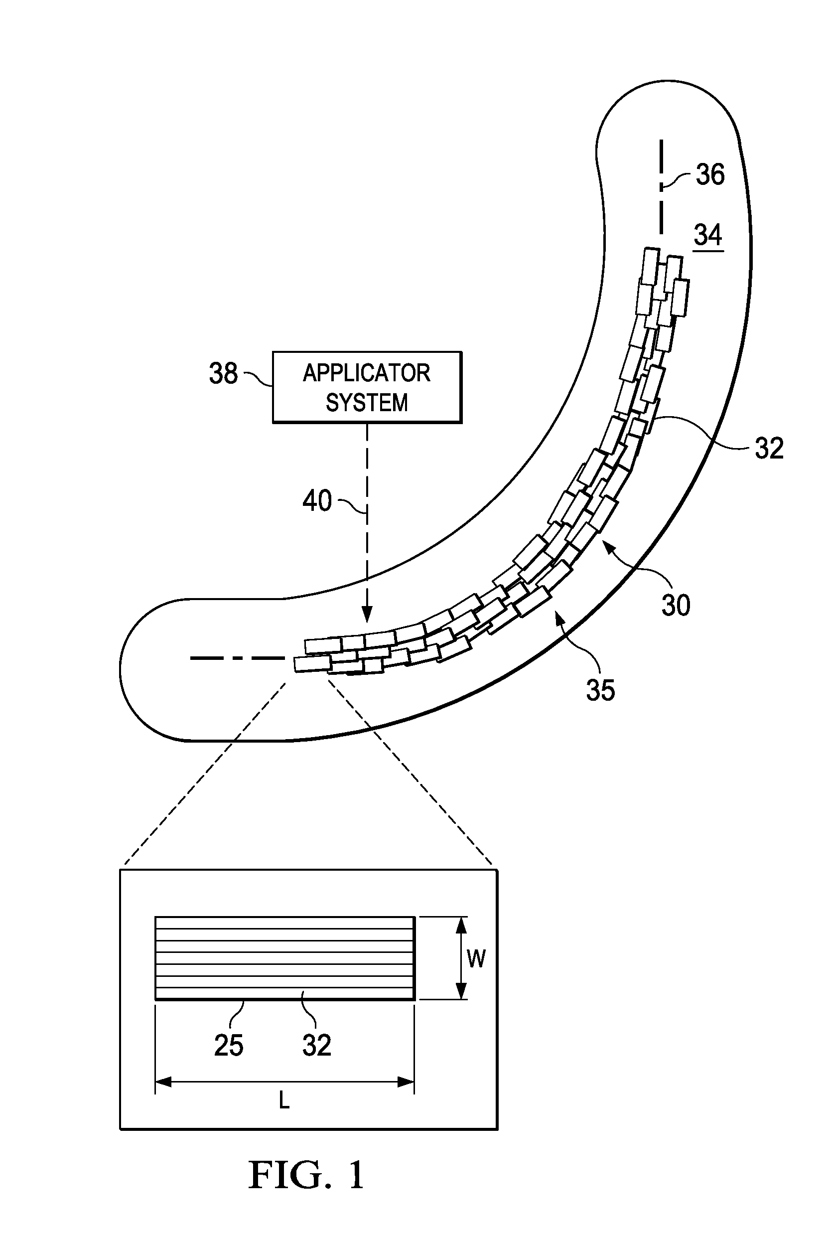 Forming Composite Features Using Steered Discontinuous Fiber Pre-Preg