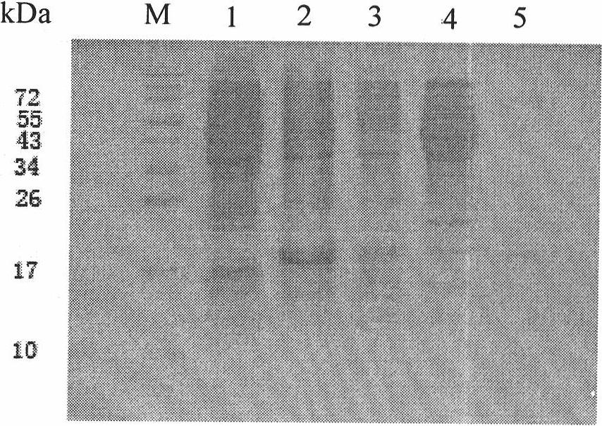 Preparation method and application of Qbeta-2aa phage virus-like particle protein