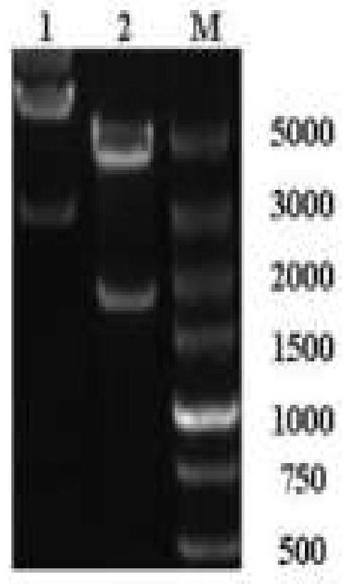 Recombinant expression vector, genetically engineered bacterium containing recombinant expression vector and application of genetically engineered bacterium
