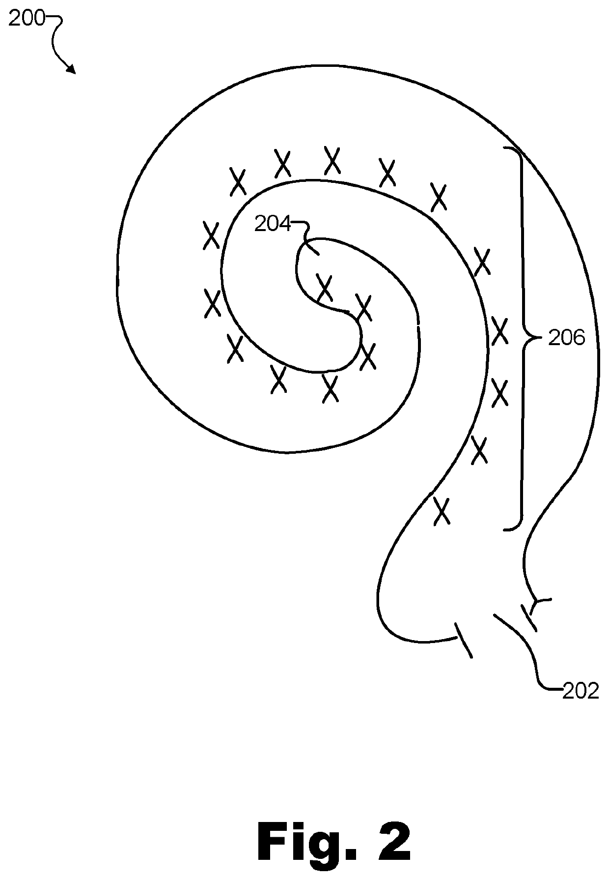 Apparatuses and methods for setting cochlear implant system stimulation parameters based on electrode impedance measurements