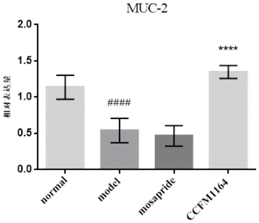 Lactobacillus paracasei for relieving diarrhea colon and application of lactobacillus paracasei