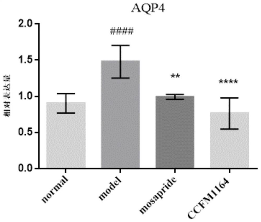 Lactobacillus paracasei for relieving diarrhea colon and application of lactobacillus paracasei