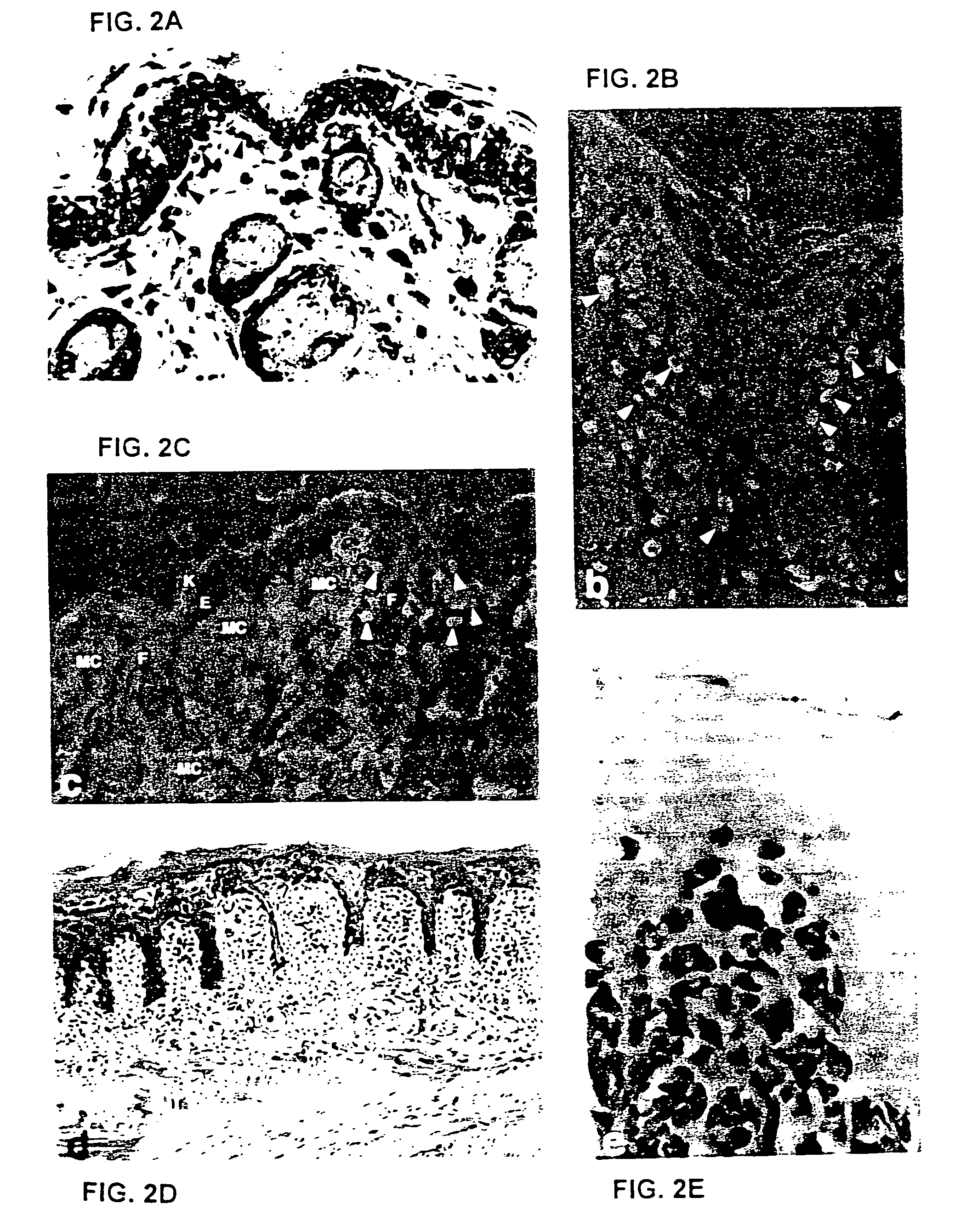 Methods of use of compounds which inhibit the stem cell signaling pathway
