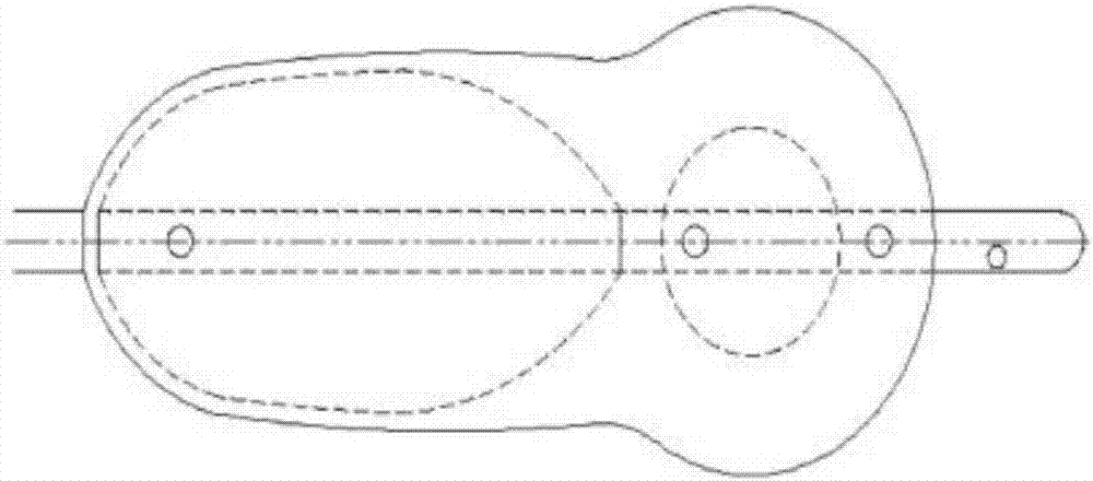 Prostatic dilation catheter with internal capsule shifted forwards