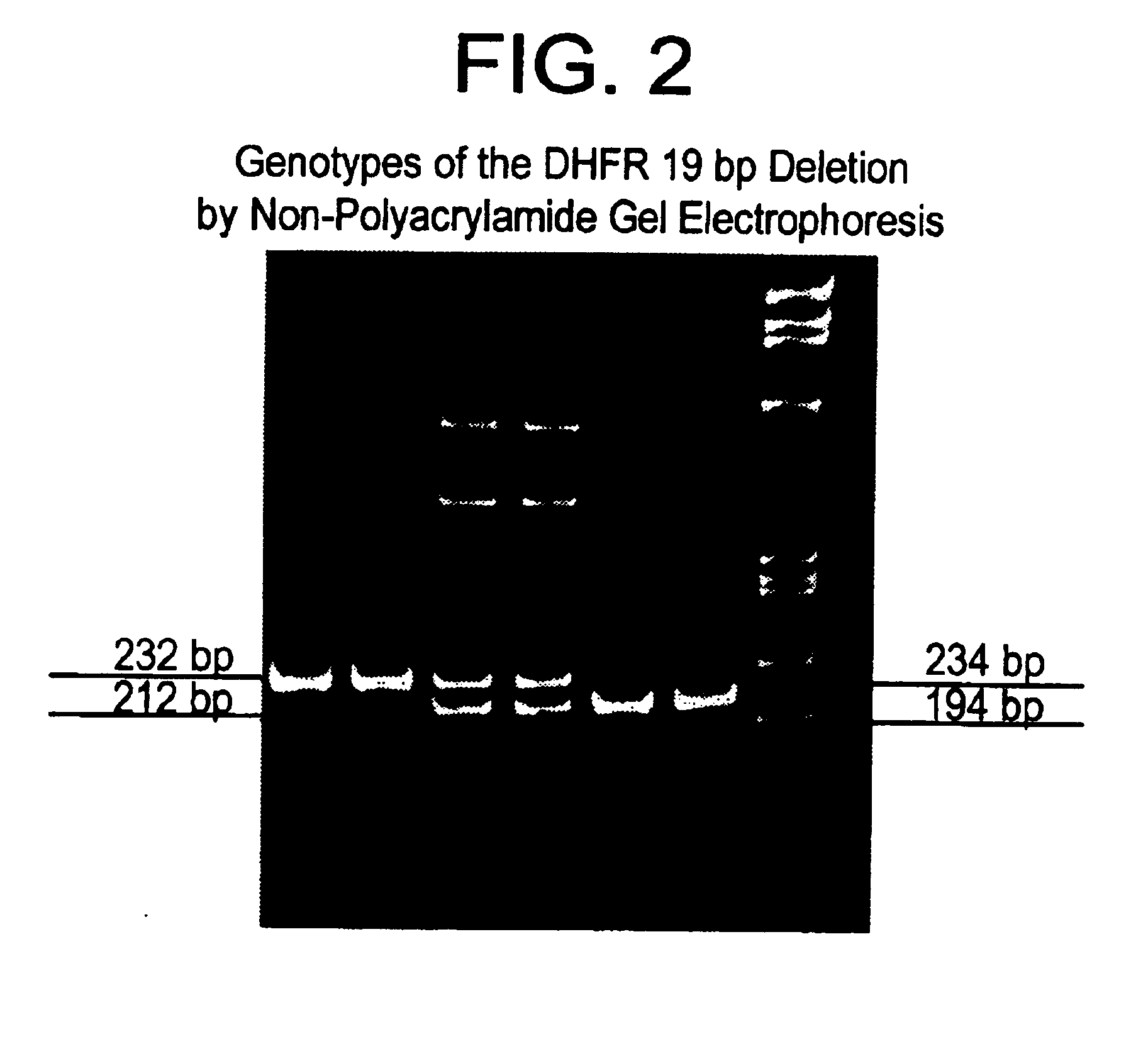 Methods for diagnosing, preventing, and treating developmental disorders due to a combination of genetic and environmental factors
