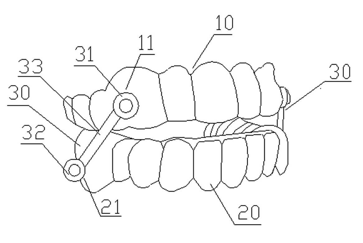 Snore guard and manufacturing method thereof