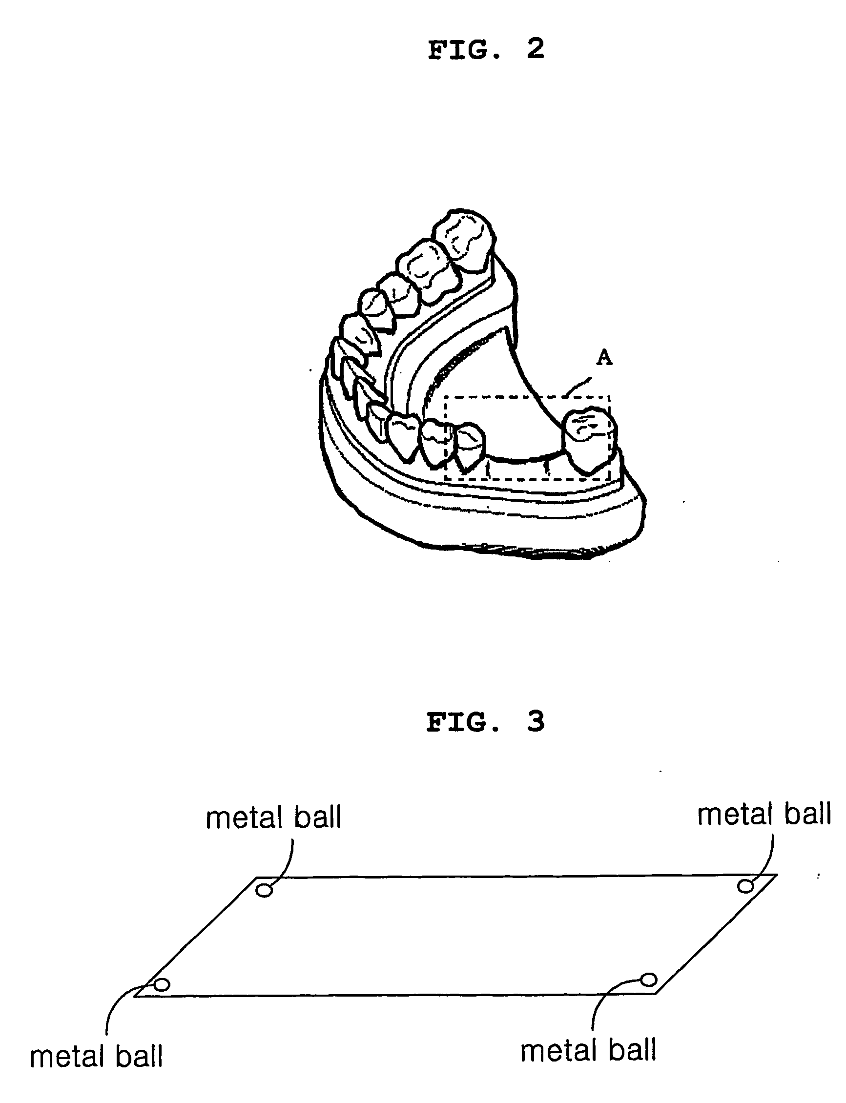 Stent for guiding the location/direction of implant, and production method thereof