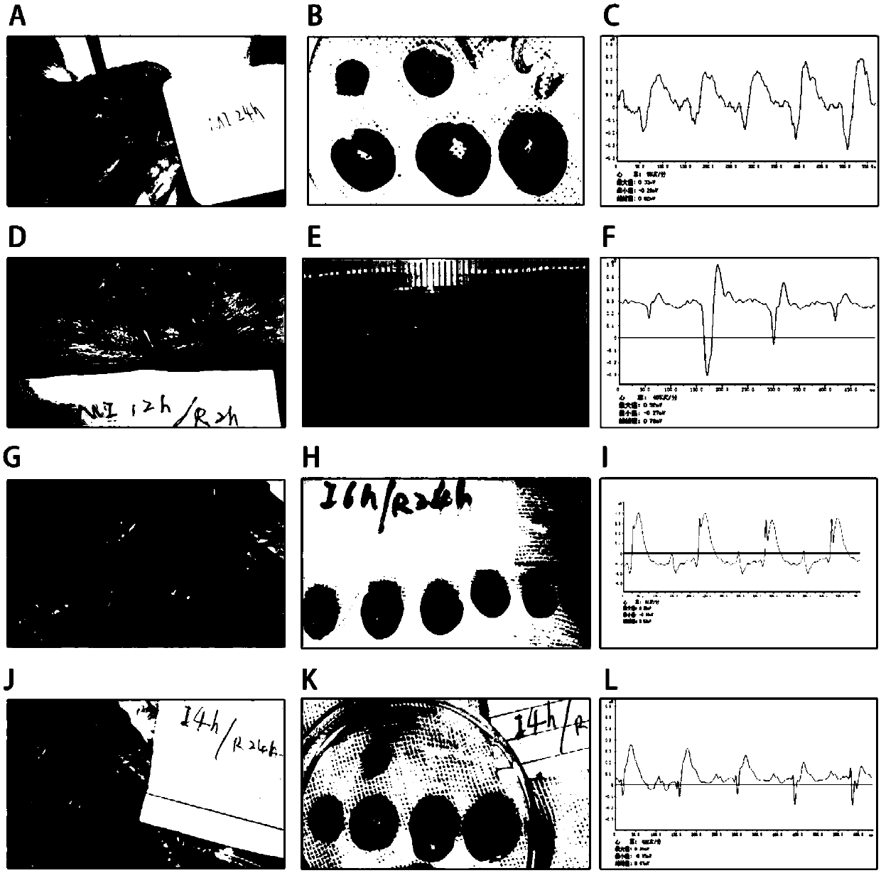 Method for constructing rat myocardial delayed ischemia reperfusion injury model