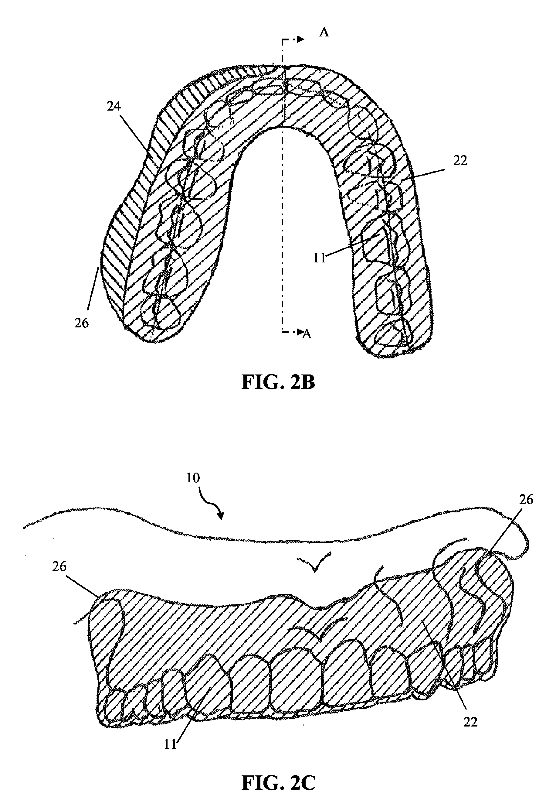 Intra-oral appliance and methods of using same