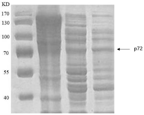 P72 fusion protein of African swine fever virus , and preparation method and application thereof