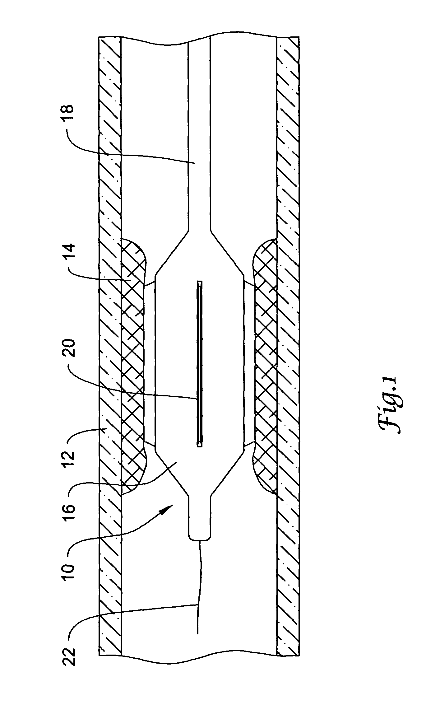 Catheter having a cutting balloon including multiple cavities or multiple channels