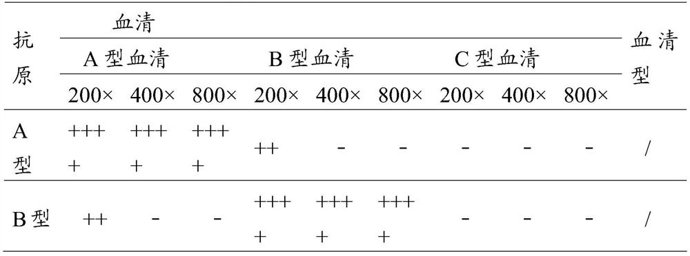 A kind of Avian bacillus paragallinarum bacterial strain and application thereof