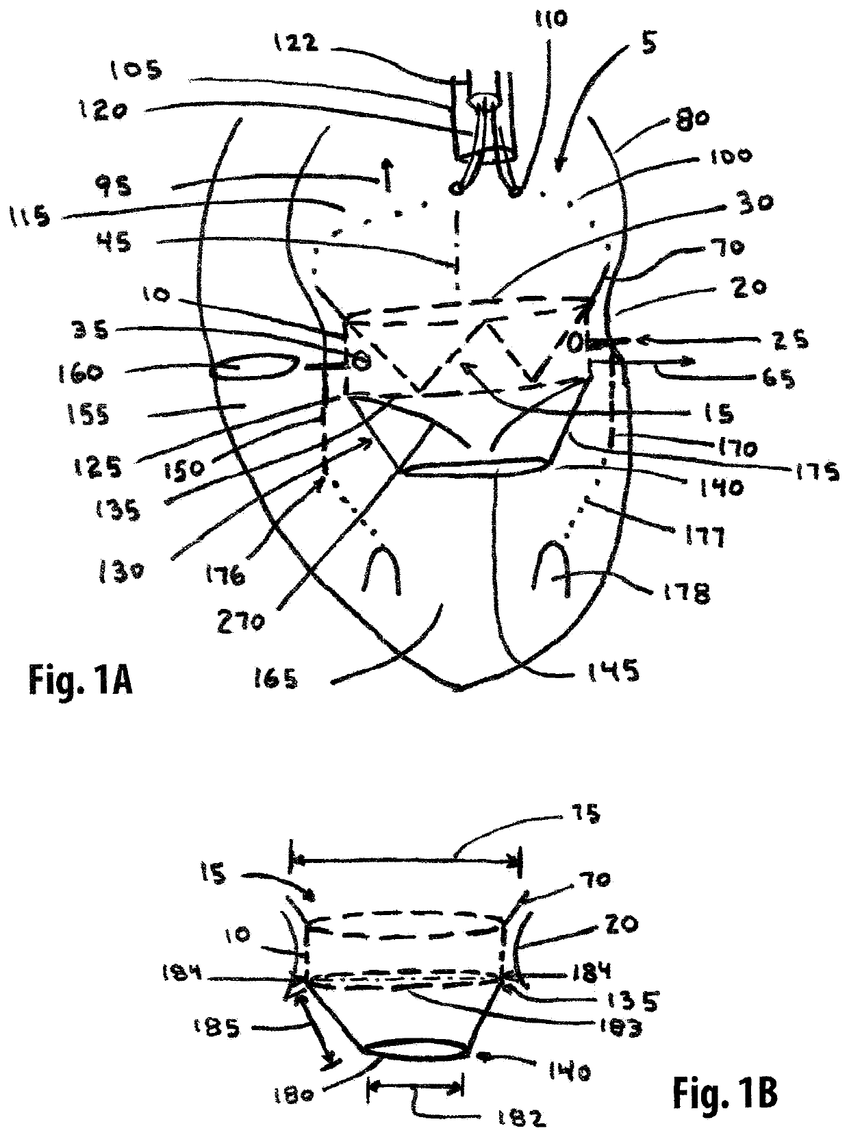 Annuloplasty device and methods