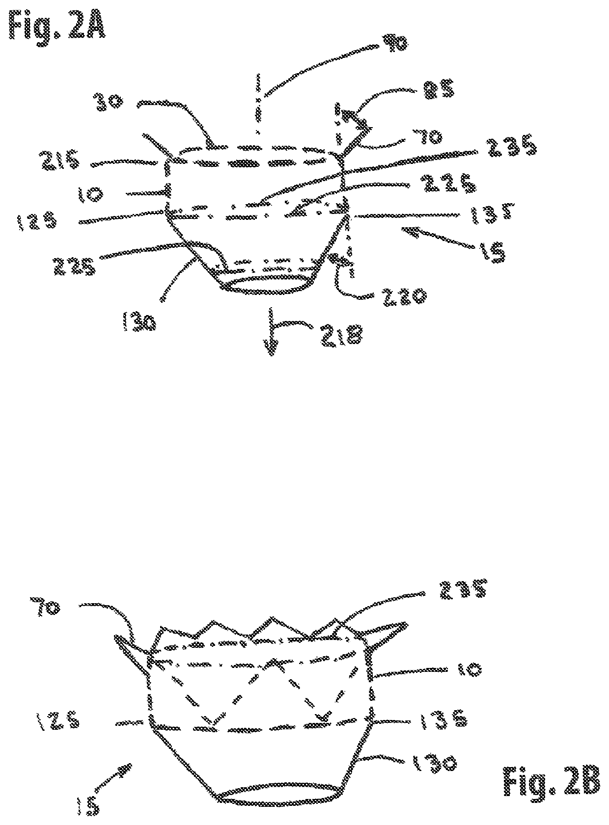 Annuloplasty device and methods