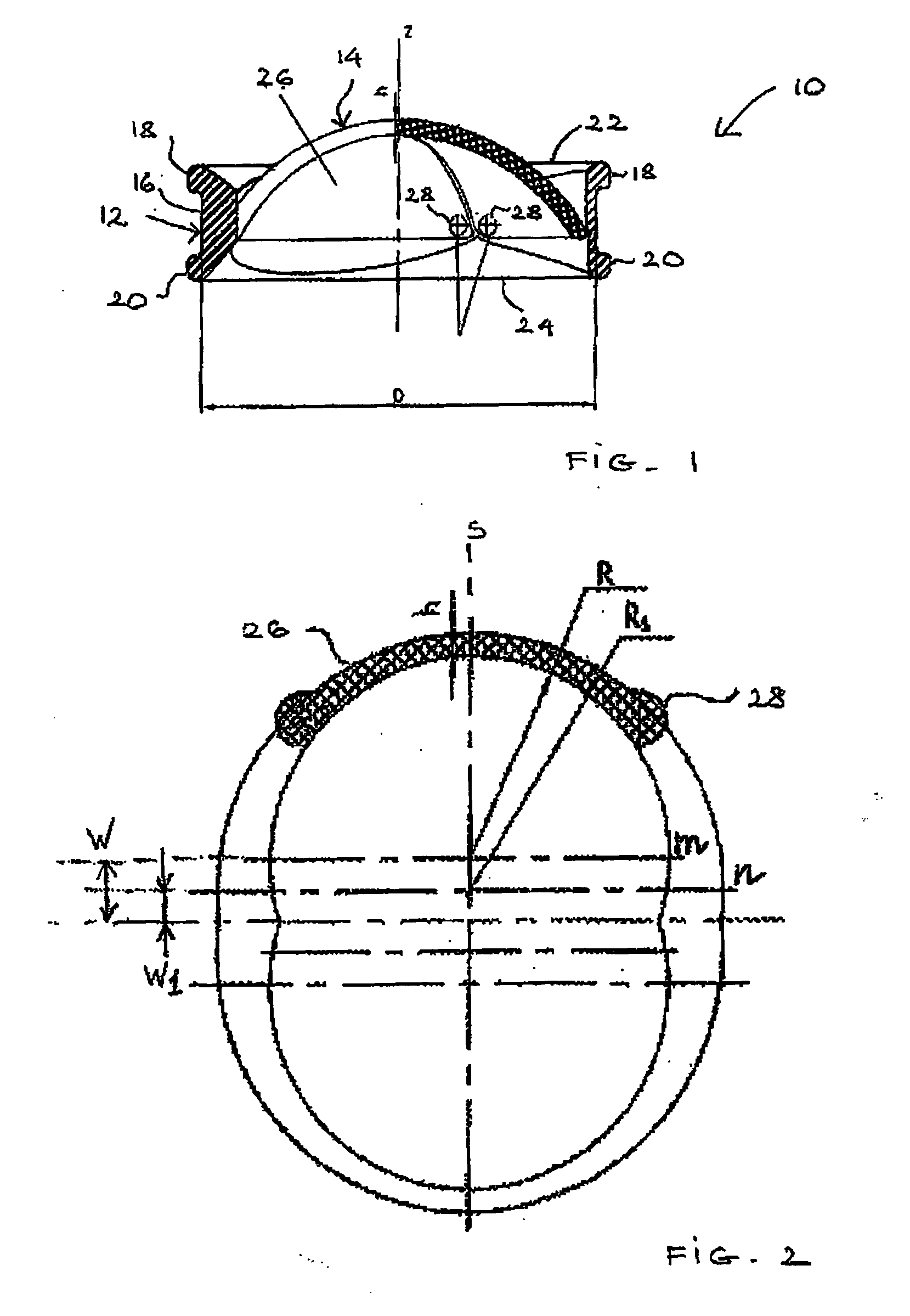 Heart Valve Prosthesis