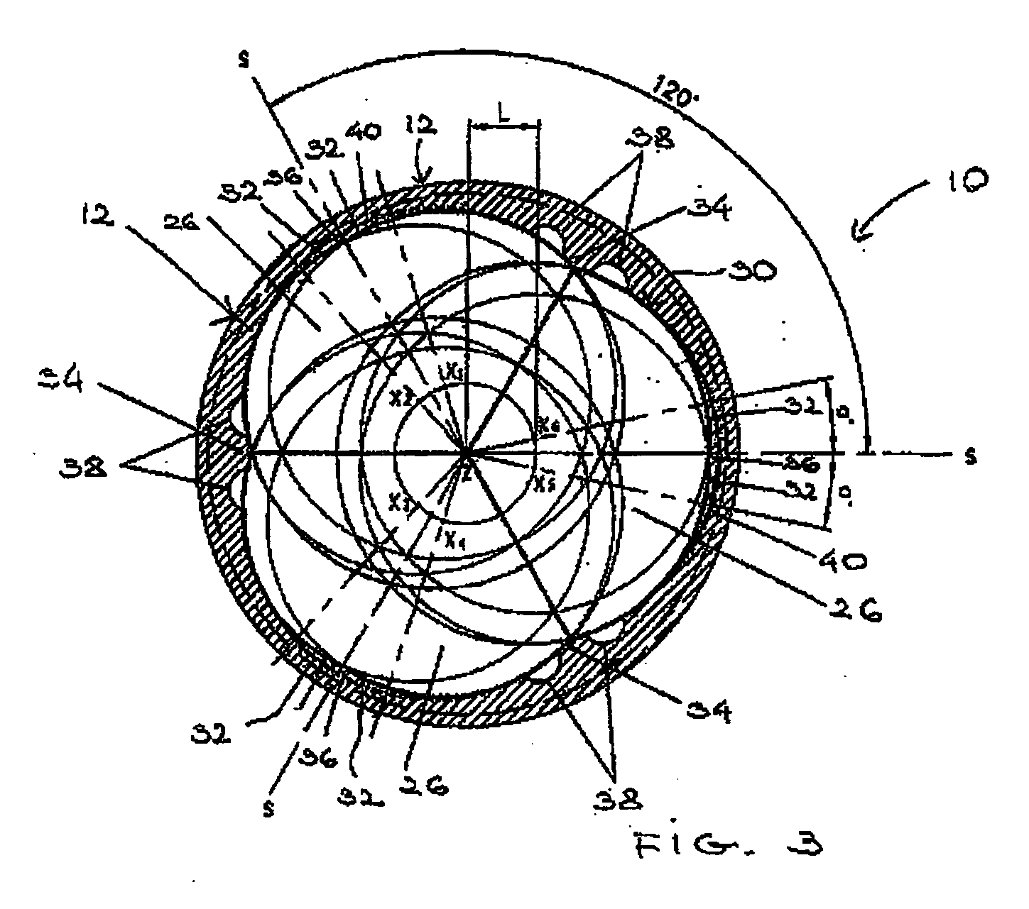 Heart Valve Prosthesis