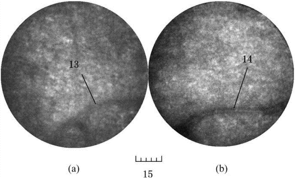 A system for adaptive optics imaging of micro blood vessels in the retinal inner nucleus