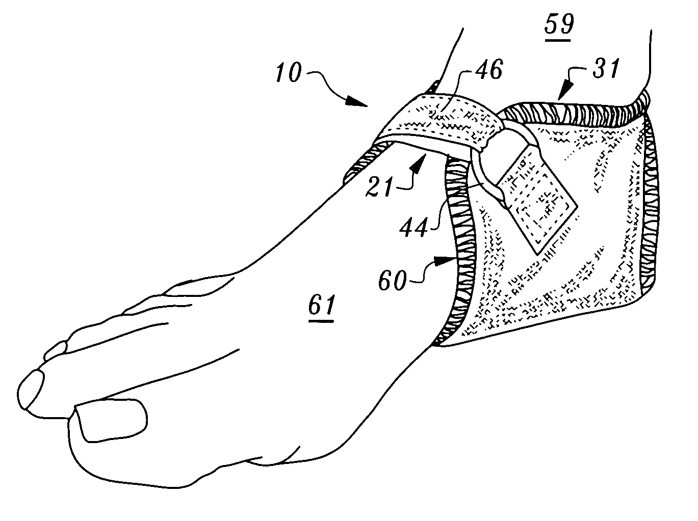 Cracked heel protector