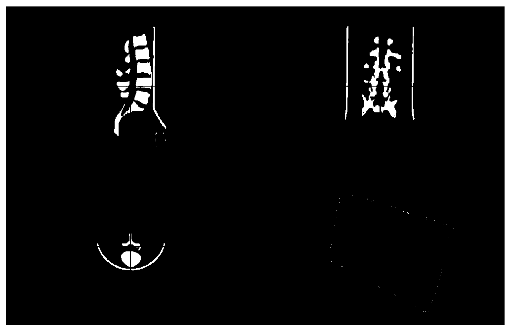 Three-dimensional simulated surgical nail planning method and surgical simulator