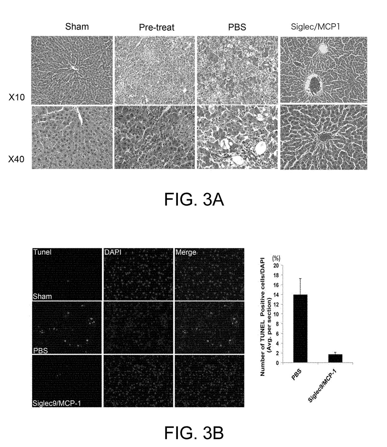 Composition having tissue-repairing activity, and use therefor