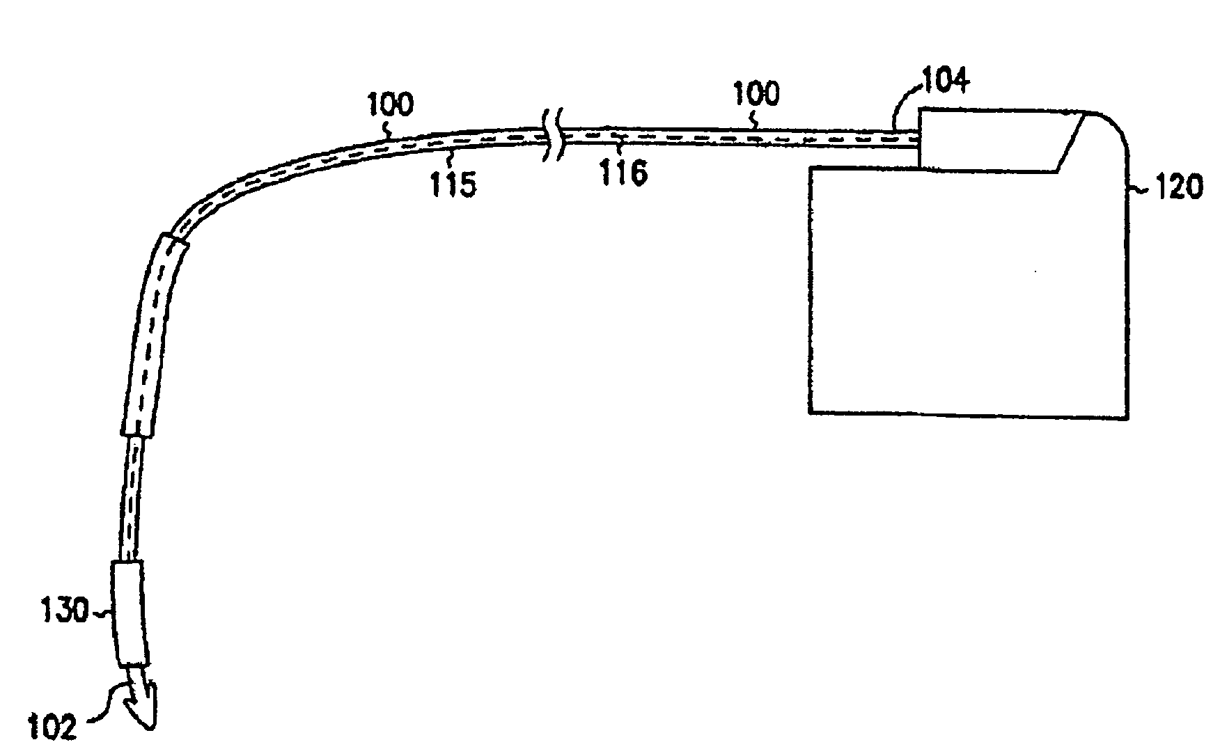 Conductive polymer patterned electrode for pacing