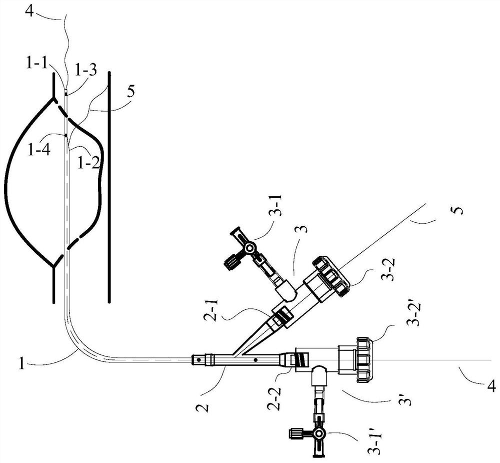 Dual Lumen Contrast Catheter