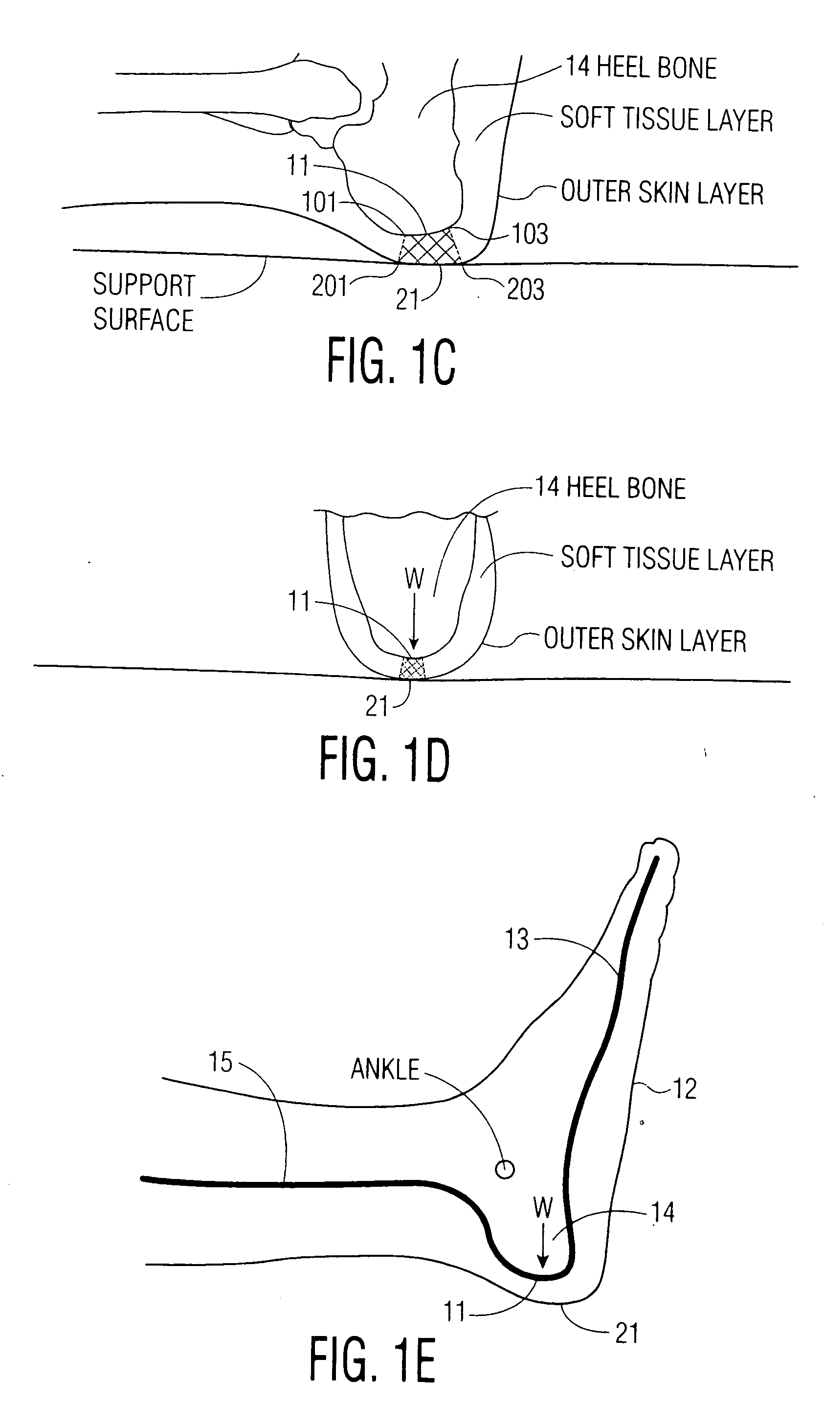 Apparatus and methods for preventing and/or healing pressure ulcers