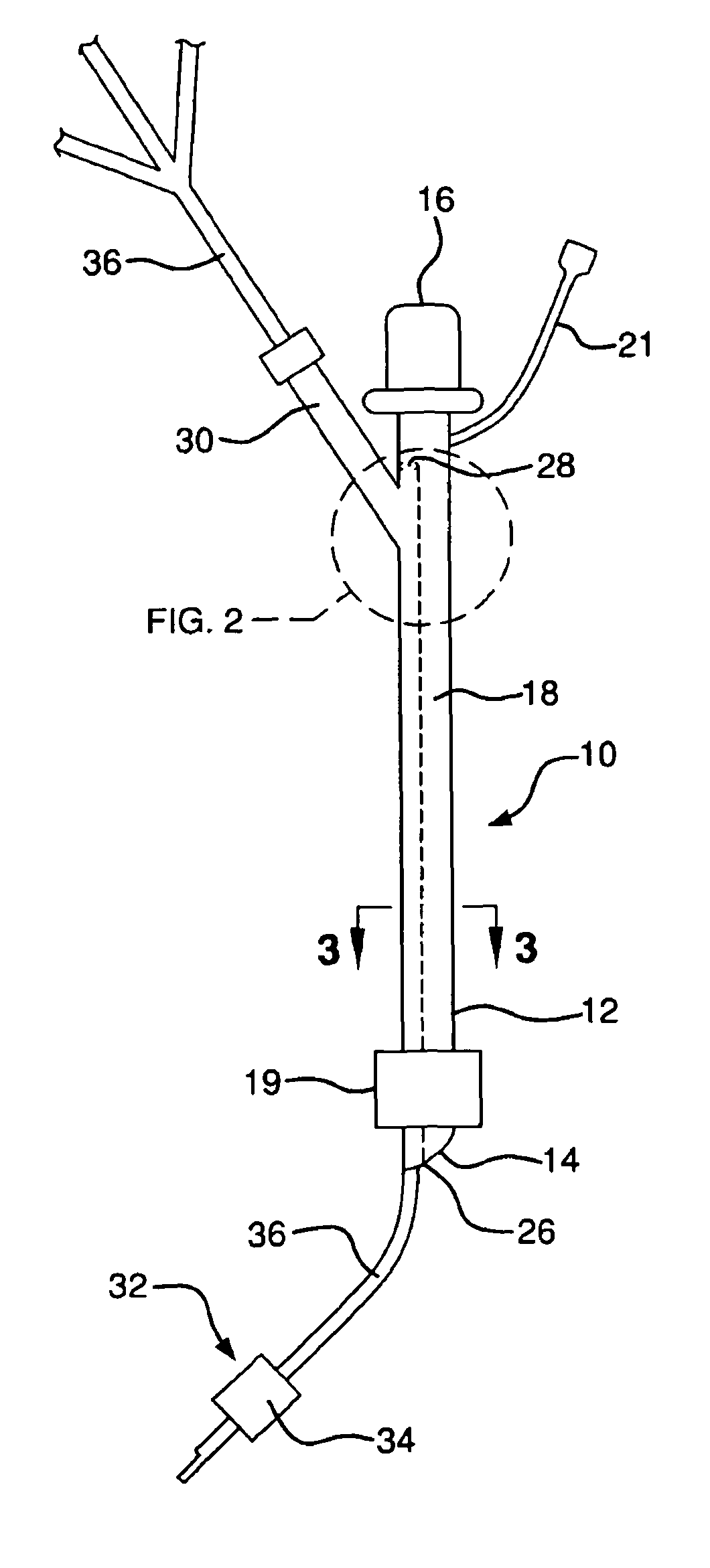 Device and method for unilateral lung ventilation