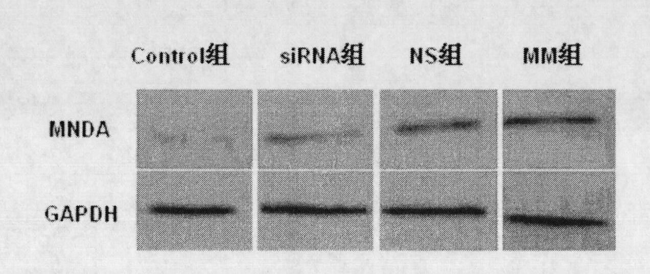 Small RNA for human and rat-homologous NMDA receptor NR2B and application thereof