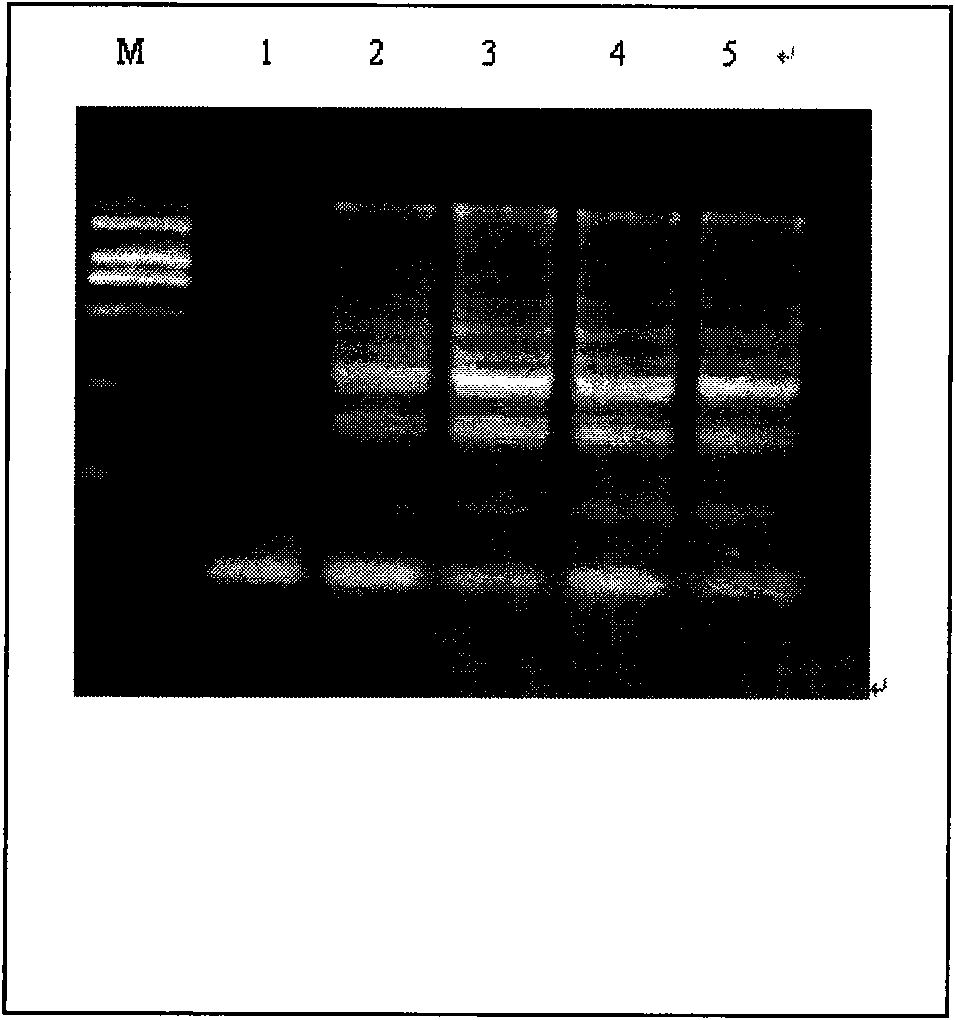 Porcine reproductive and respiratory syndrome virus RT-LAMP detection kit and detection method thereof