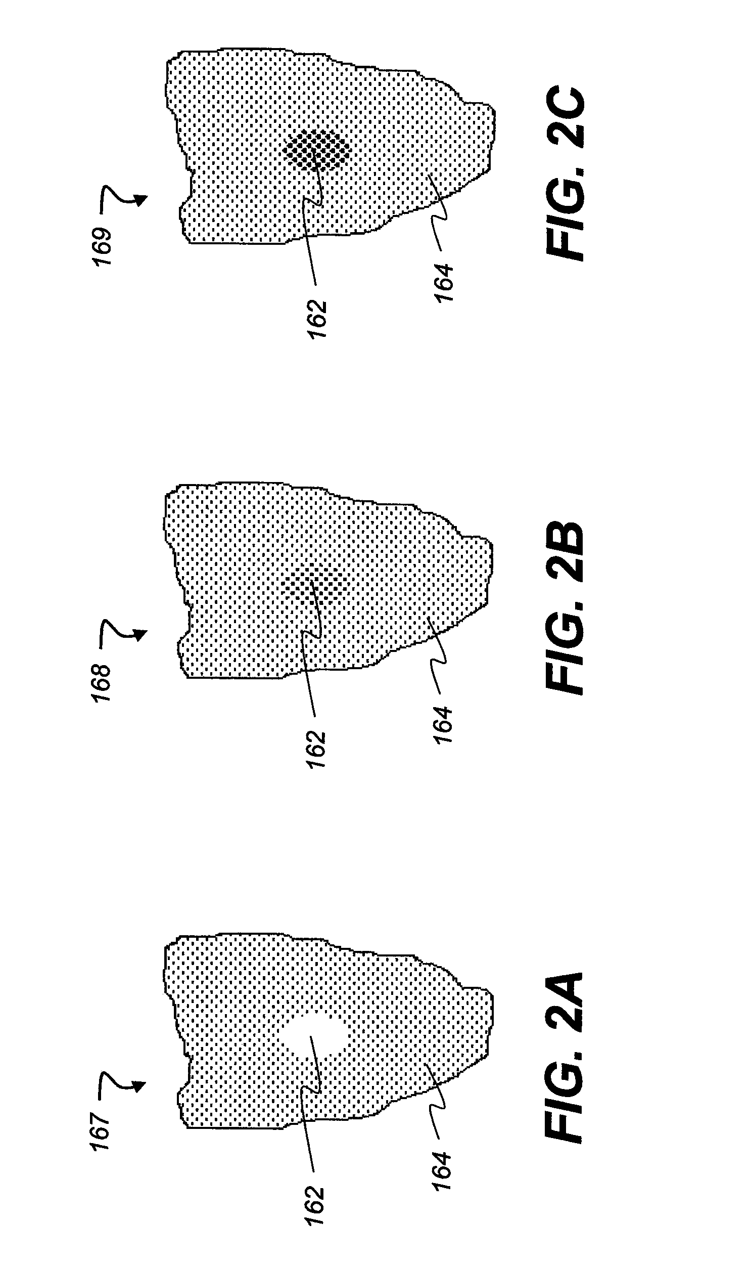 Method for extracting a carious lesion area