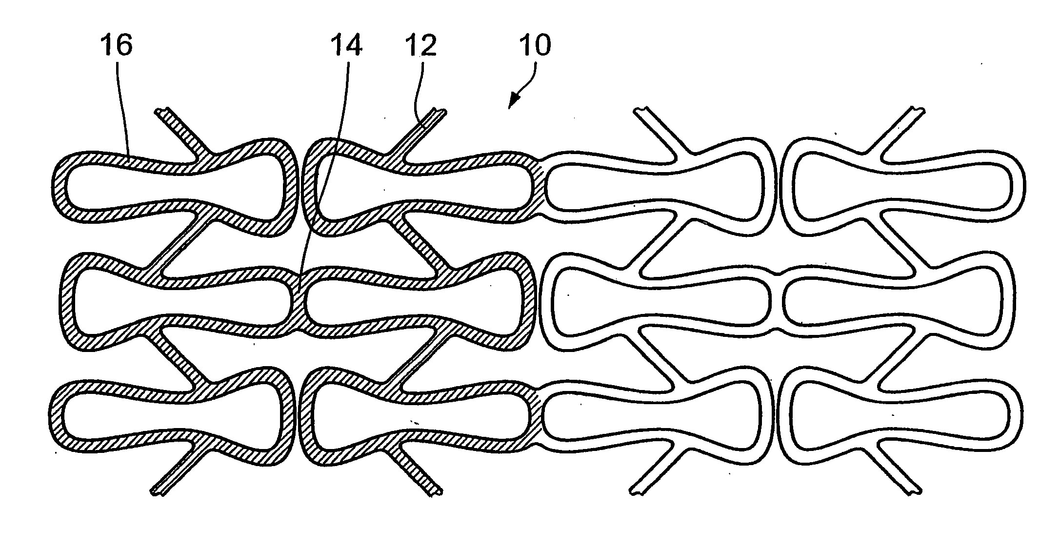 Stent with polymeric coating