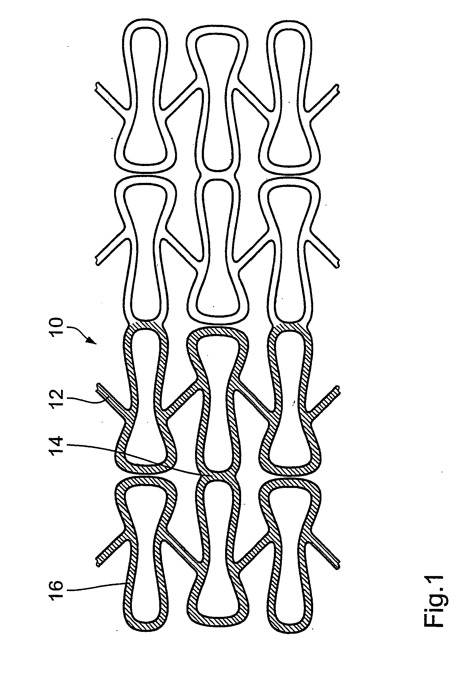 Stent with polymeric coating