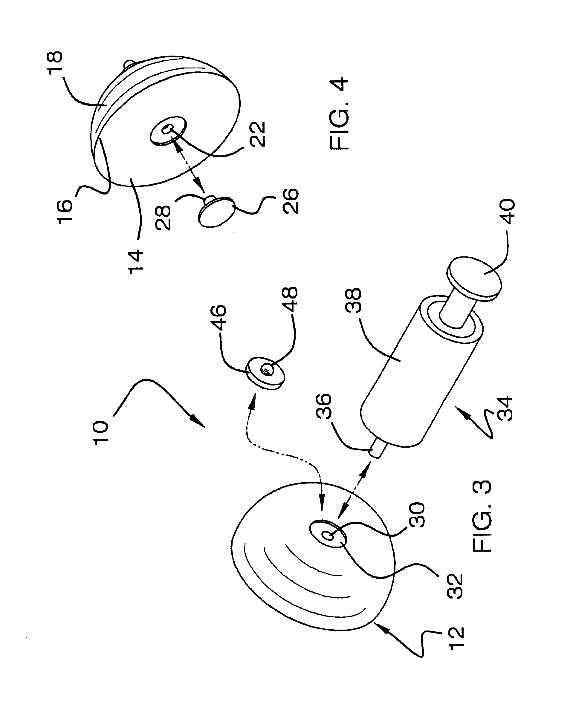 Inflatable prosthetic device