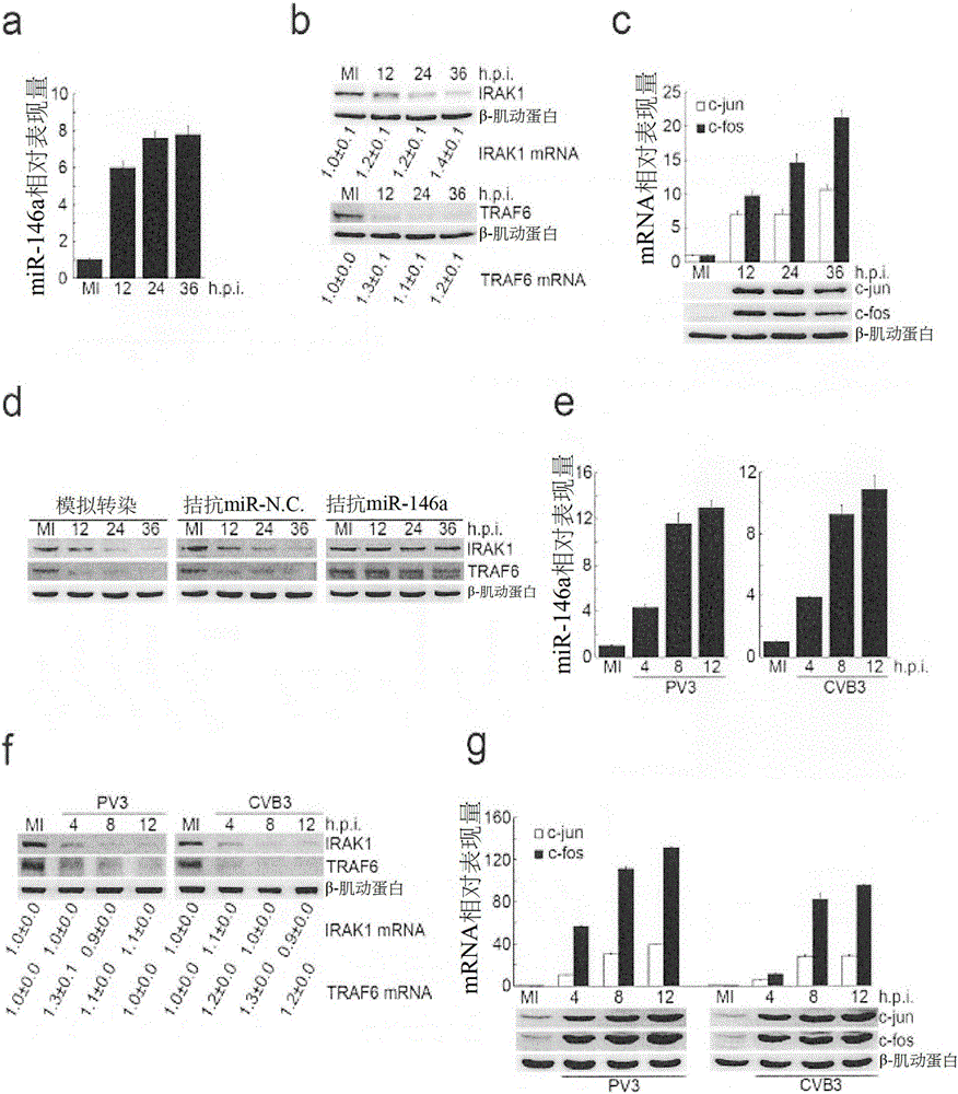 Use of microrna 146-a in the diagnosis, treatment and prevention of picornavirus infection and microran 146-a antagonists