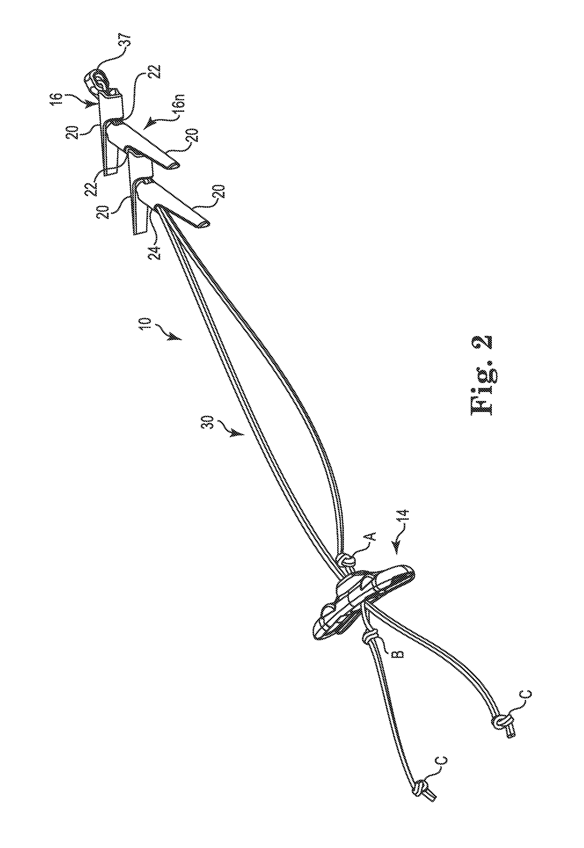Surgical implant system and method