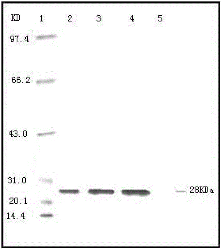 Vaccine composition containing porcine circovirus type 2 antigen and Haemophilus parasuis antigen and its preparation method and application