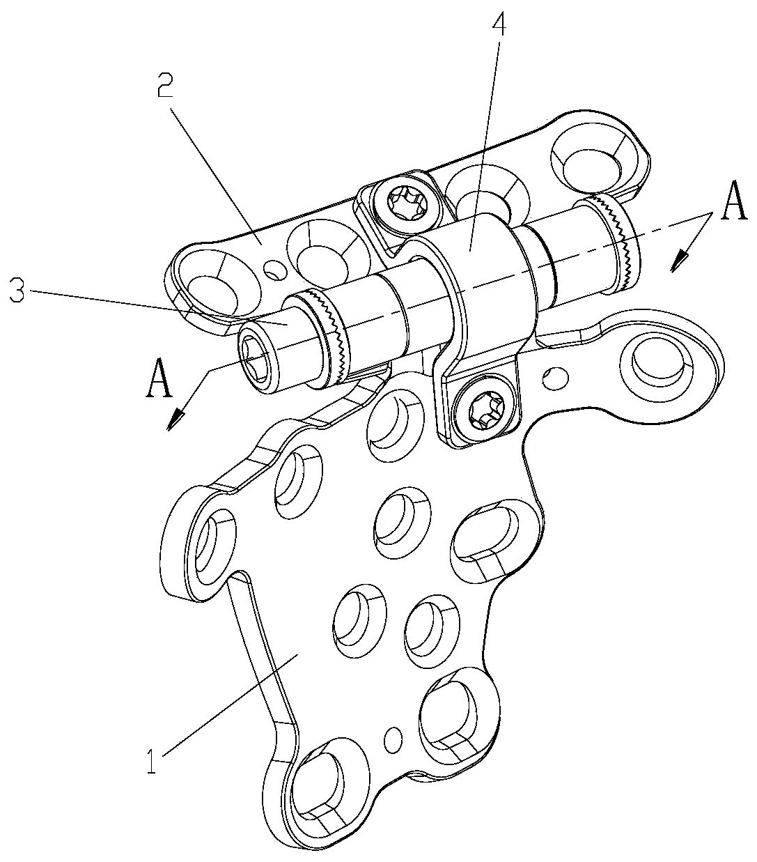 Folding pelvic plate for acetabulum quadrilateral fracture