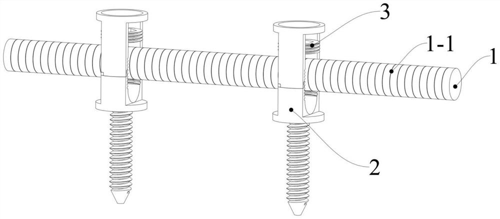 A pedicle screw screw rod internal fixation device with positioning tip as inner core