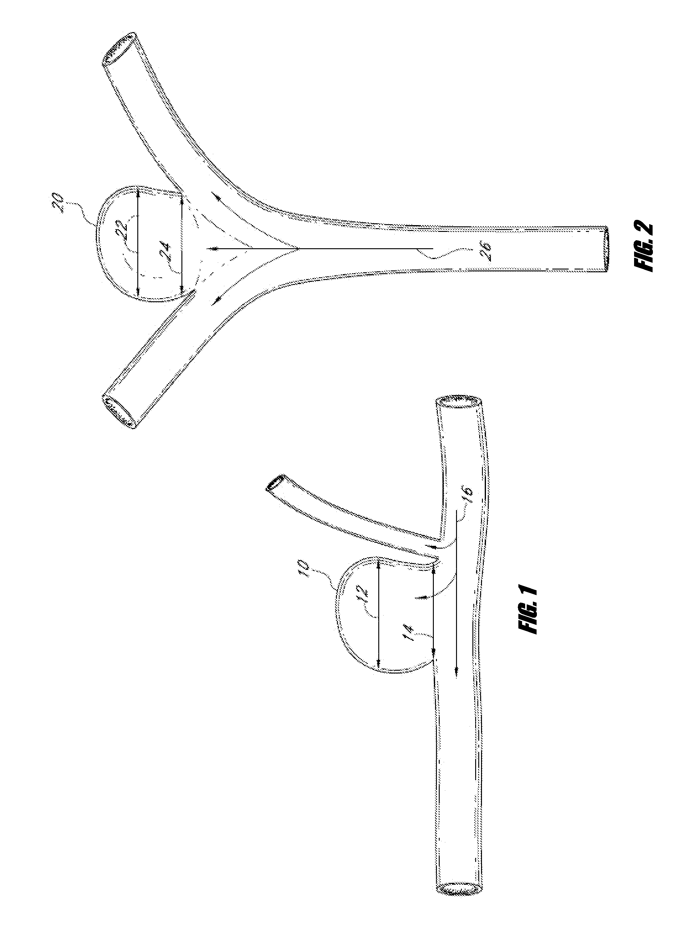 Vascular remodeling device