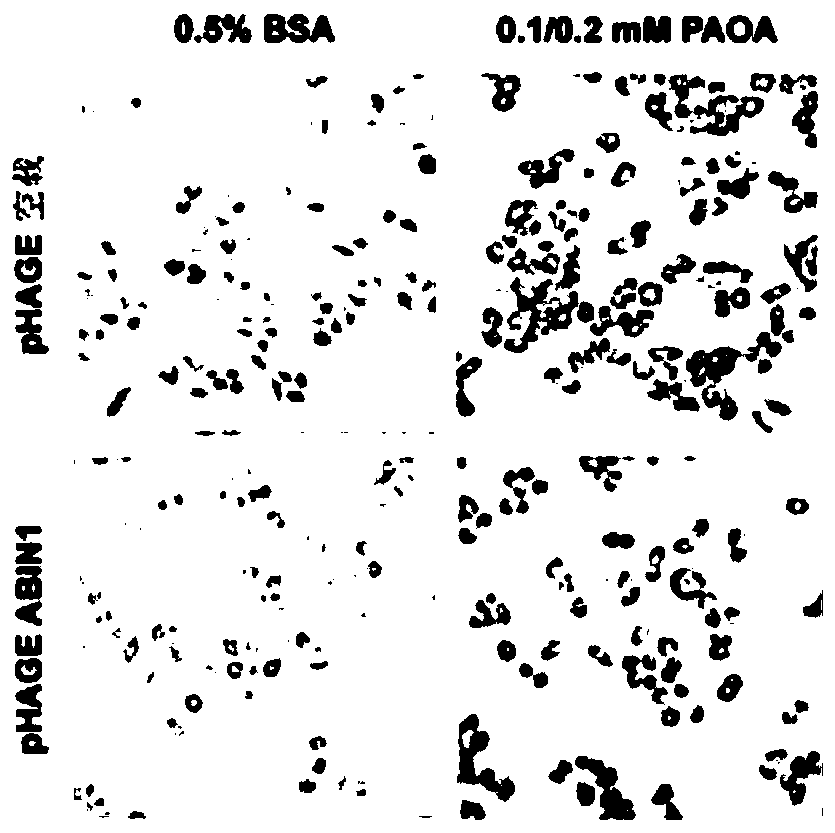 Application of nuclear factor kappa b inhibitory protein 1 combined with a20 in the preparation of drugs for treating fatty liver and related diseases