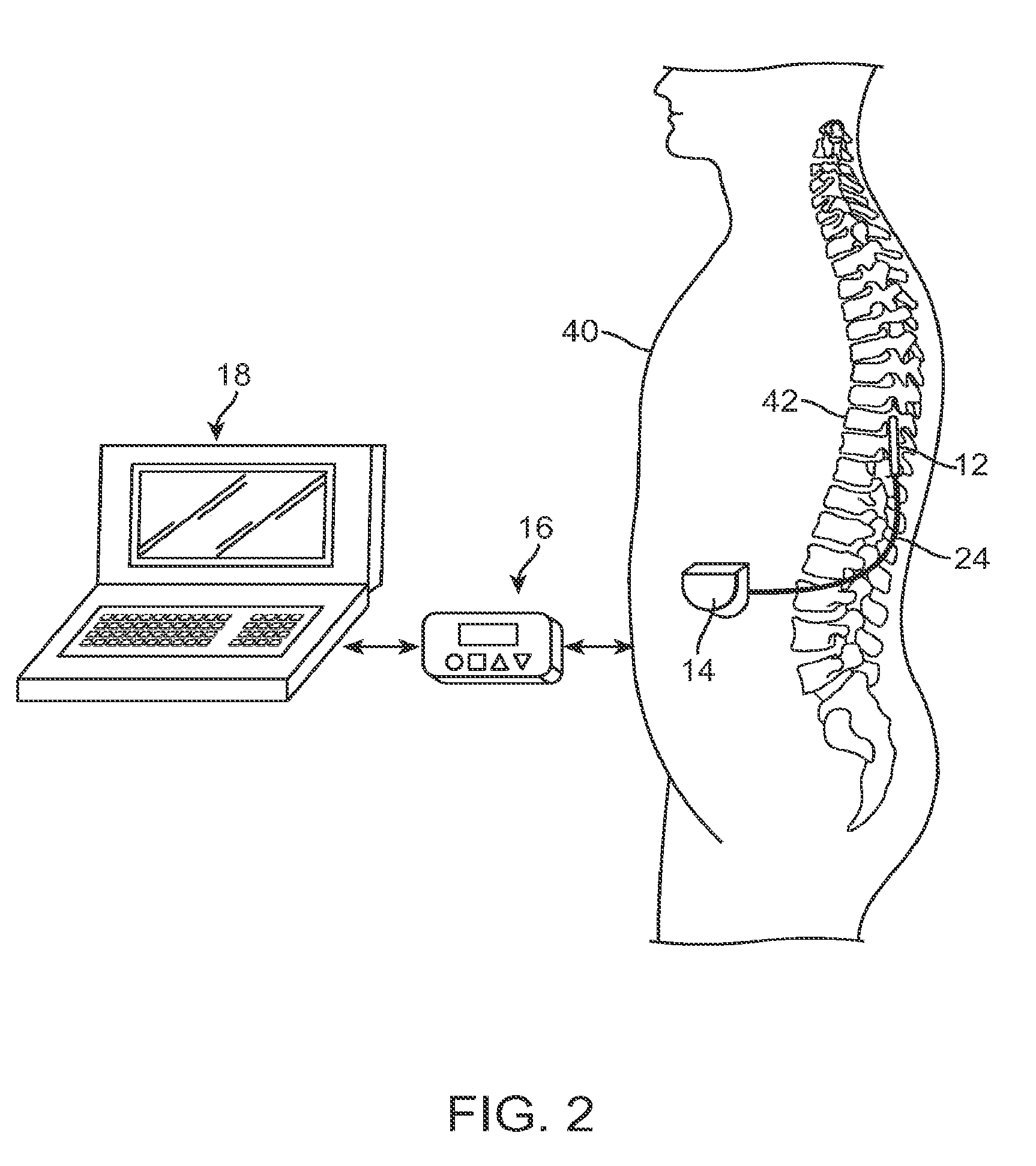 Methods and devices for treatment of non-neuropathic conditions using electrical stimulation