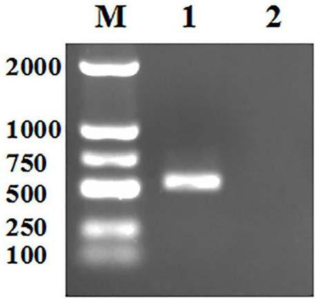 Applications of echinococcus granulosus mitochondrion gene ND6