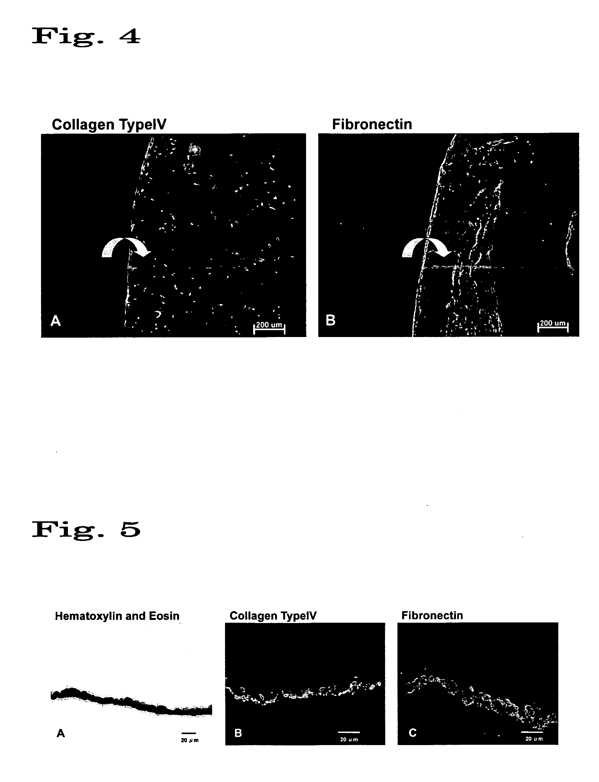Regenerated corneal endothelial cell sheets, processes for producing the same, and methods of using the same