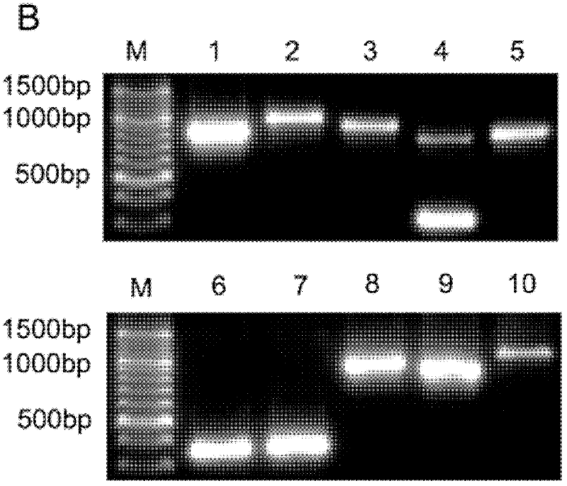 Immune nano-carrier for conveying siRNA (small interfering Ribonucleic Acid) and preparation method and application thereof