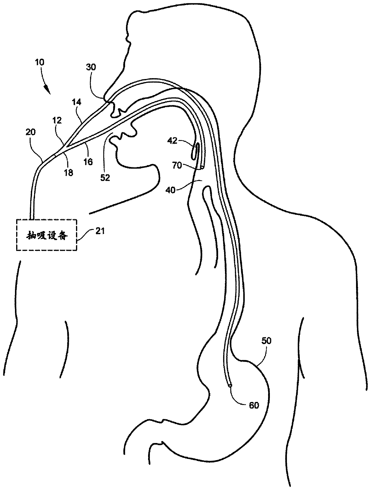 Medical apparatus with hypopharyngeal suctioning capability