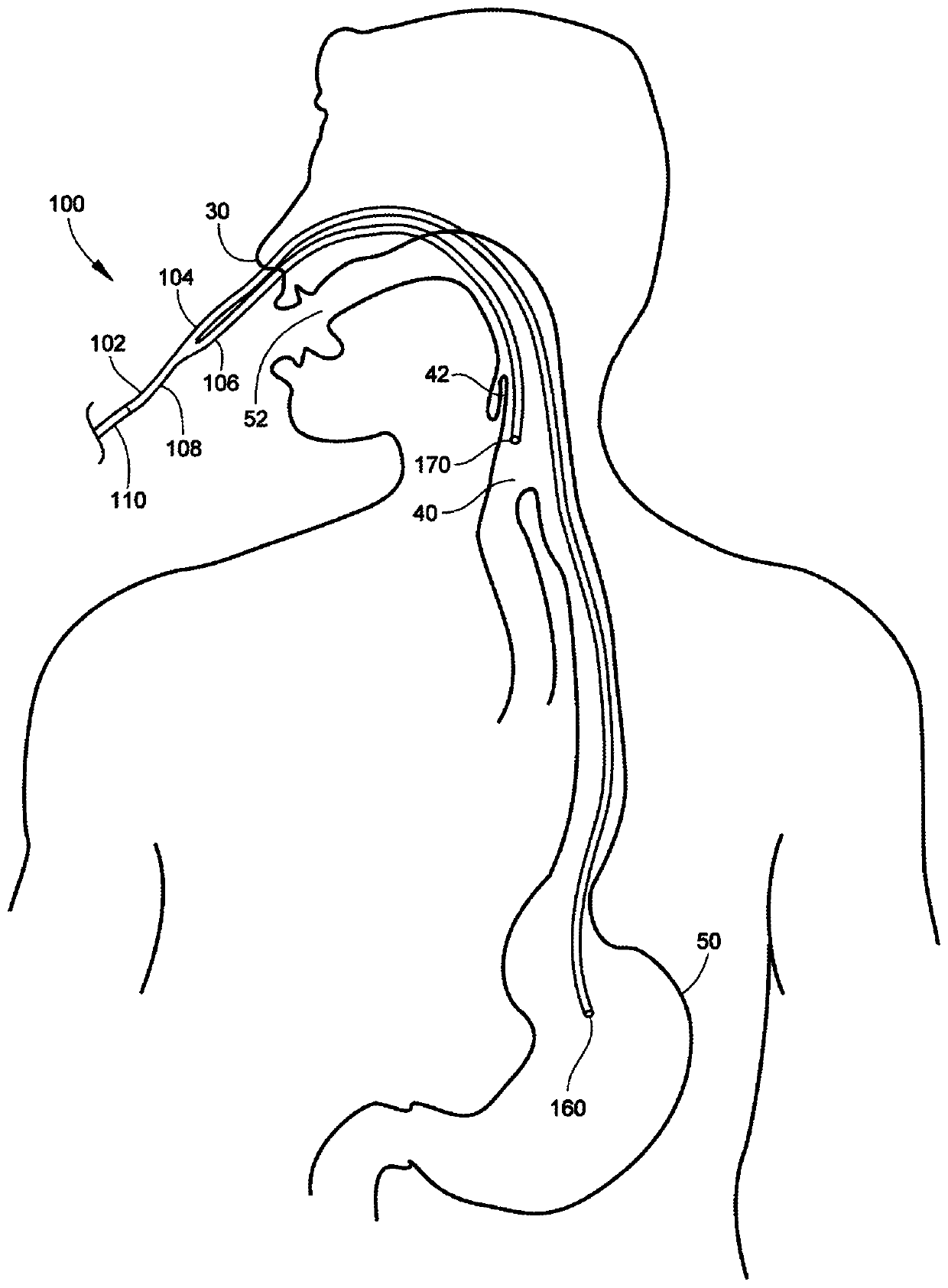 Medical apparatus with hypopharyngeal suctioning capability