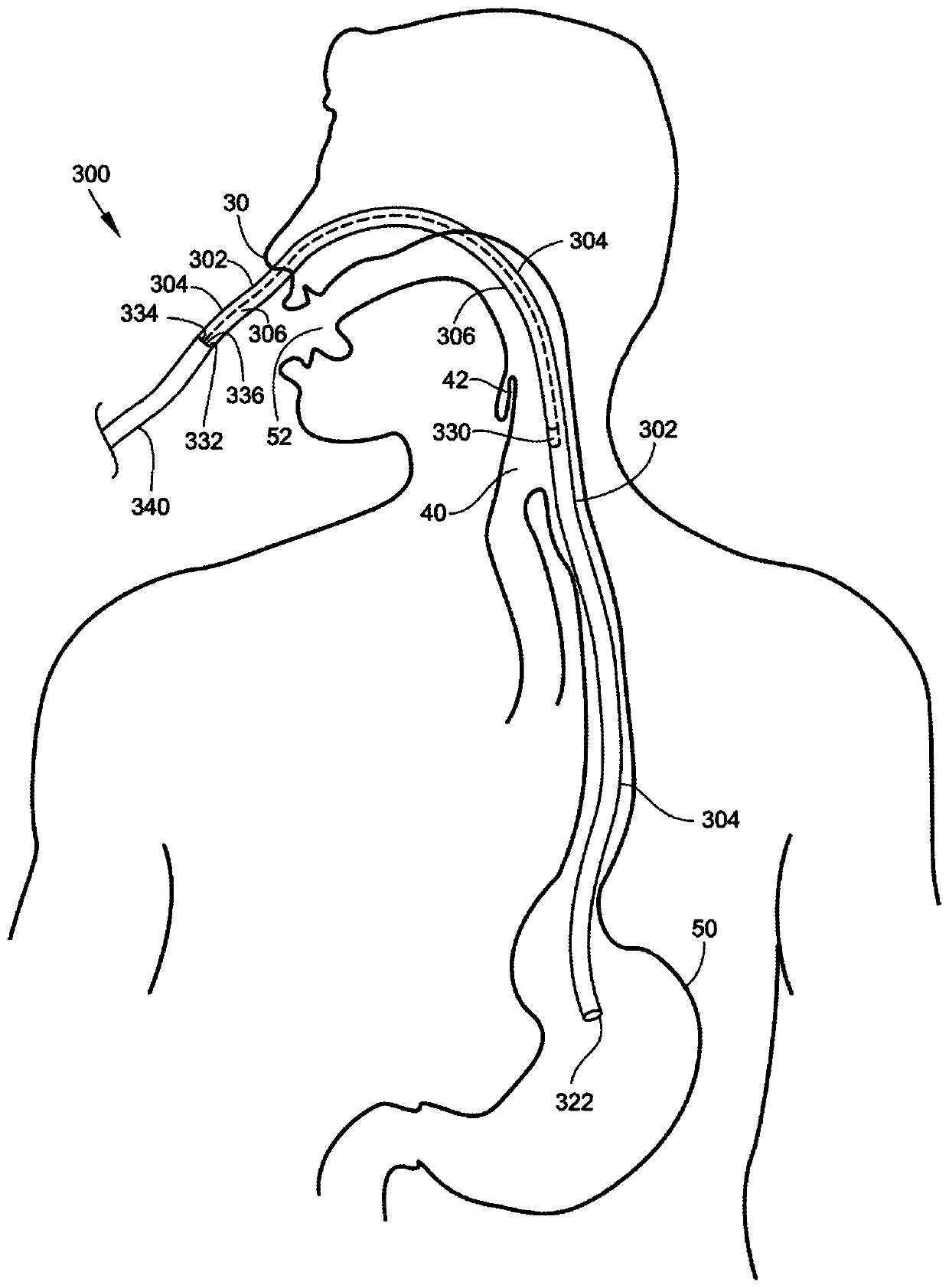 Medical apparatus with hypopharyngeal suctioning capability