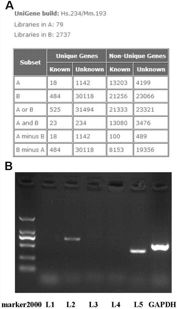 Long-chain non-coding RNA (Ribonucleic Acid) correlated to occurrence and development of human hepatocellular carcinoma, amplification detection method and application