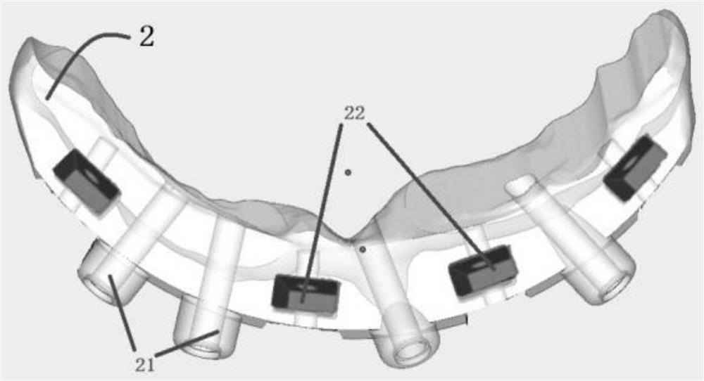 Whole-course digital combined guide plate suitable for full-mouth implant surgery